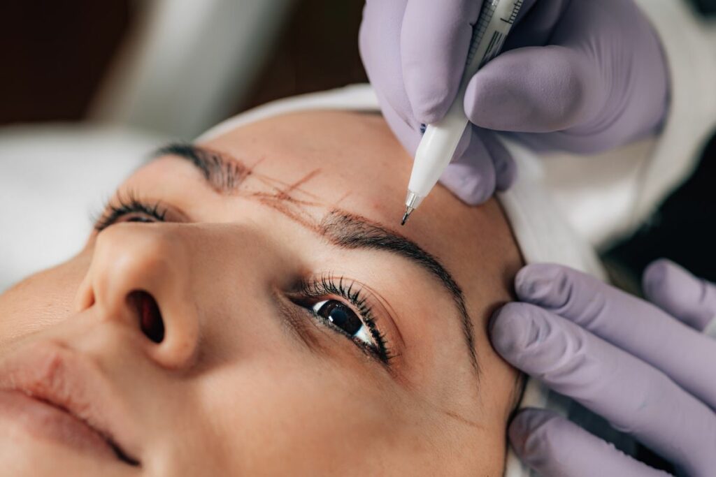 Brow lift